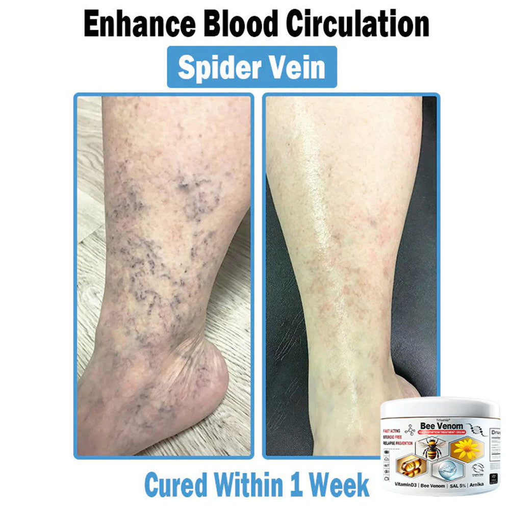 Trilumia® Bee Venom Multi-Symptom Skin Treatment Cream(👨⚕ Recommended by the British Association of Dermatologists – BAD) ⏰50% Off for a Limited Time – Sponsored by Boots