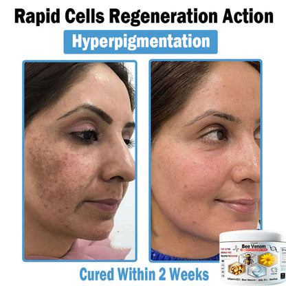 Trilumia® Bee Venom Multi-Symptom Skin Treatment Cream(👨‍⚕ Recommended by the British Association of Dermatologists – BAD) ⏰50% Off for a Limited Time – Sponsored by Boots