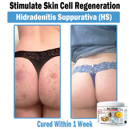 Trilumia® Bee Venom Multi-Symptom Skin Treatment Cream(👨‍⚕ Recommended by the British Association of Dermatologists – BAD) ⏰50% Off for a Limited Time – Sponsored by Boots