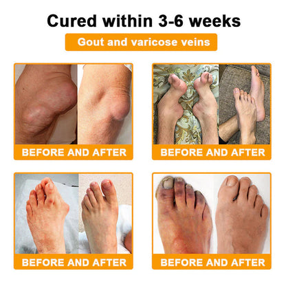 Trilumia® Botulinum Toxin & Bee Venom Pain-Relief Bone Healing Cream🌟⏰50% Off for a Limited Time – Sponsored by Boots