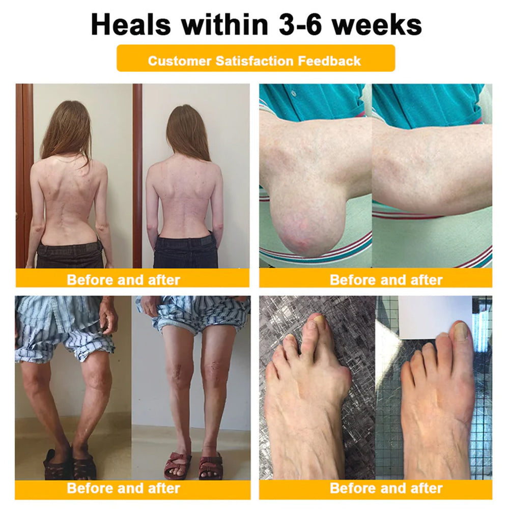 Trilumia® Botulinum Toxin & Bee Venom Pain-Relief Bone Healing Cream🌟⏰50% Off for a Limited Time – Sponsored by Boots