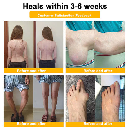 Trilumia® Botulinum Toxin & Bee Venom Pain-Relief Bone Healing Cream🌟⏰50% Off for a Limited Time – Sponsored by Boots