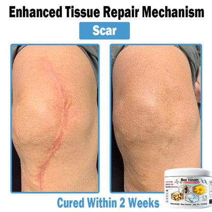 Trilumia® Bee Venom Multi-Symptom Skin Treatment Cream(👨‍⚕ Recommended by the British Association of Dermatologists – BAD) ⏰50% Off for a Limited Time – Sponsored by Boots