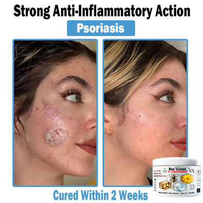 Trilumia® Bee Venom Multi-Symptom Skin Treatment Cream(👨‍⚕ Recommended by the British Association of Dermatologists – BAD) ⏰50% Off for a Limited Time – Sponsored by Boots