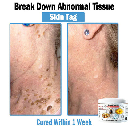 Trilumia® Bee Venom Multi-Symptom Skin Treatment Cream(👨‍⚕ Recommended by the British Association of Dermatologists – BAD) ⏰50% Off for a Limited Time – Sponsored by Boots