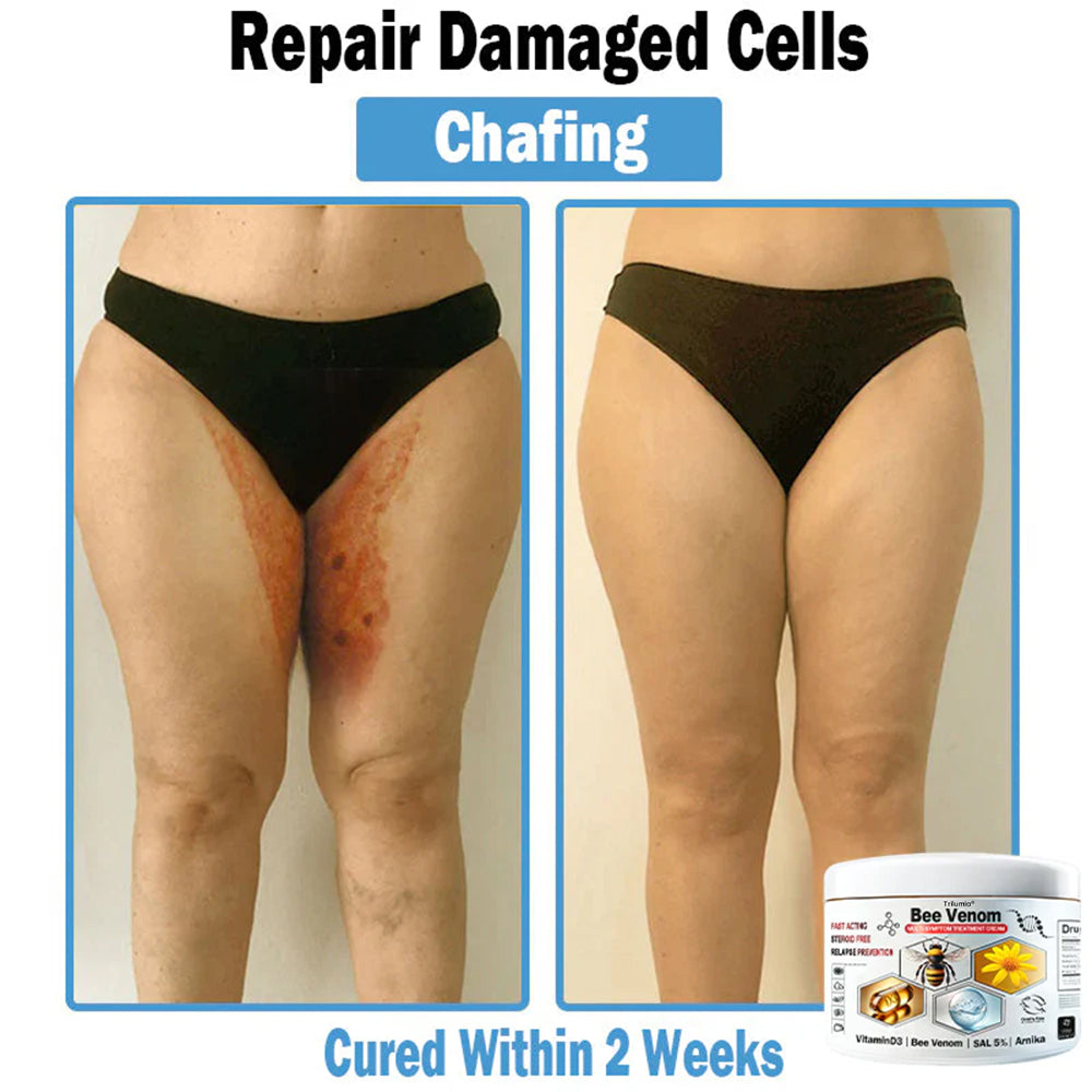 Trilumia® Bee Venom Multi-Symptom Skin Treatment Cream(👨‍⚕ Recommended by the British Association of Dermatologists – BAD) ⏰50% Off for a Limited Time – Sponsored by Boots