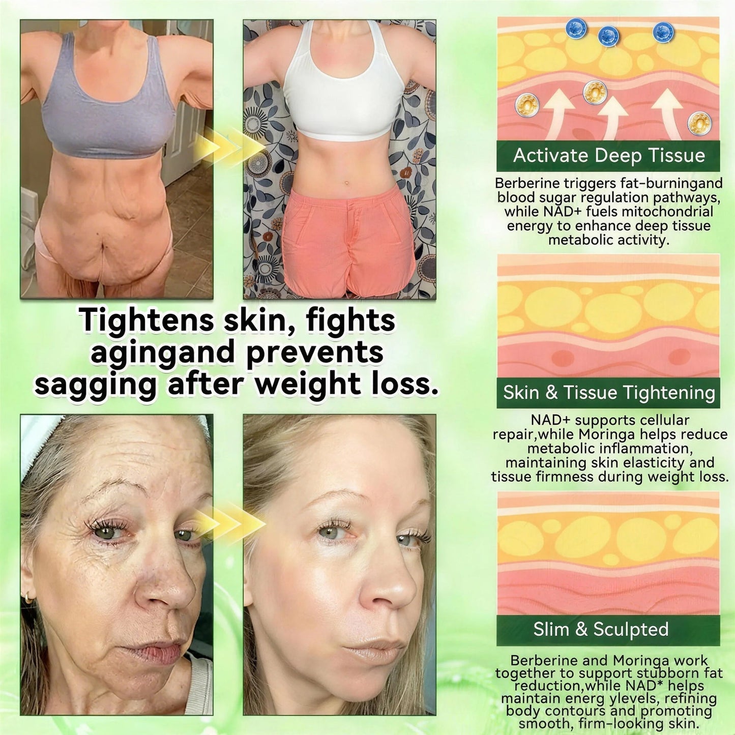 𝗢𝗳𝗳𝗶𝗰𝗶𝗮𝗹 𝘀𝘁𝗼𝗿𝗲  | 𝖲𝗎𝗋𝗀𝗈ᴎ𝗂𝗑® ⚡𝖬𝗈𝗋𝗂𝗇𝗀ɑ · Β𝖾𝗋𝖻𝖾𝗋𝗂𝗇𝖾 & 𝖭𝖠𝖣＋ 10-𝒊𝒏-1 𝑨𝒅𝒗ɑ𝒏𝒄𝒆𝒅 𝑵ɑ𝒏𝒐 𝑴𝒊𝒄𝒓𝒐𝒏𝒆𝒆𝒅𝒍𝒆 𝑷ɑ𝒕𝒄𝒉 ✨ 𝑪𝒐𝒎𝒃ɑ𝒕 𝒐𝒃𝒆𝒔𝒊𝒕𝒚, 𝒔ɑ𝒈𝒈𝒊𝒏𝒈 𝒔𝒌𝒊𝒏, 𝒅𝒊ɑ𝒃𝒆𝒕𝒆𝒔, 𝒔𝒍𝒆𝒆𝒑 ɑ𝒑𝒏𝒆ɑ, 𝒋𝒐𝒊𝒏𝒕 𝒊𝒔𝒔𝒖𝒆𝒔 & 𝒎𝒐𝒓𝒆🏆